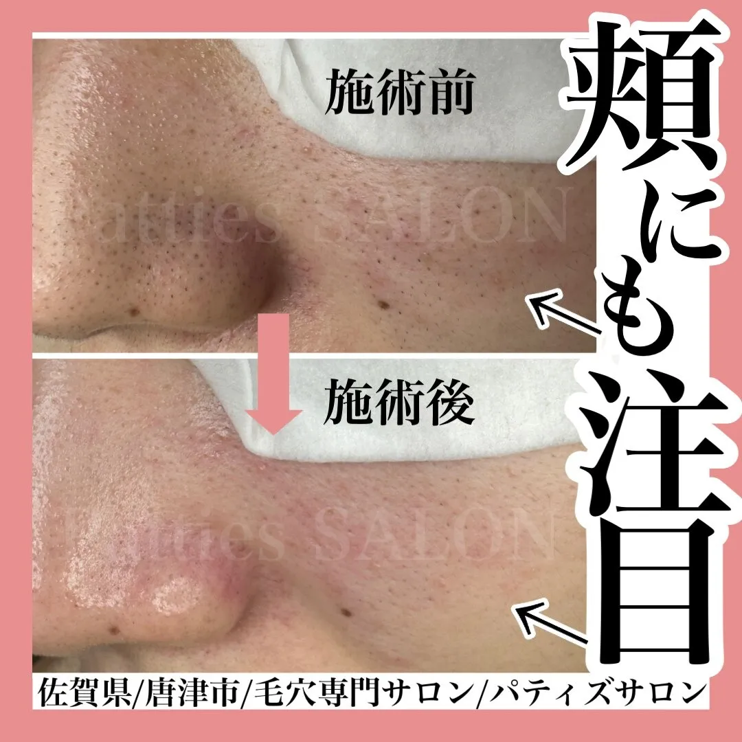 鼻だけではありません!