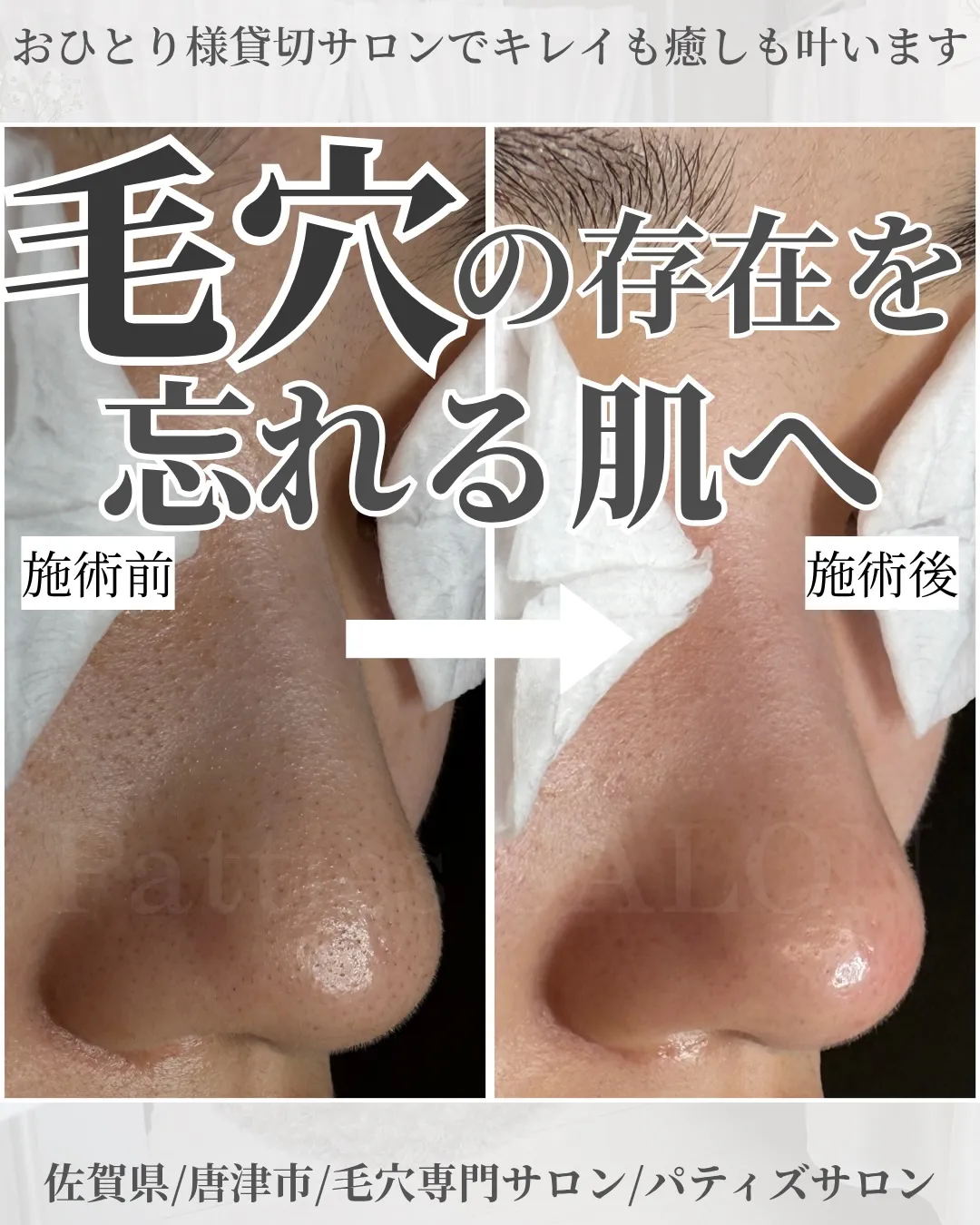 毛穴の存在を忘れる肌へ