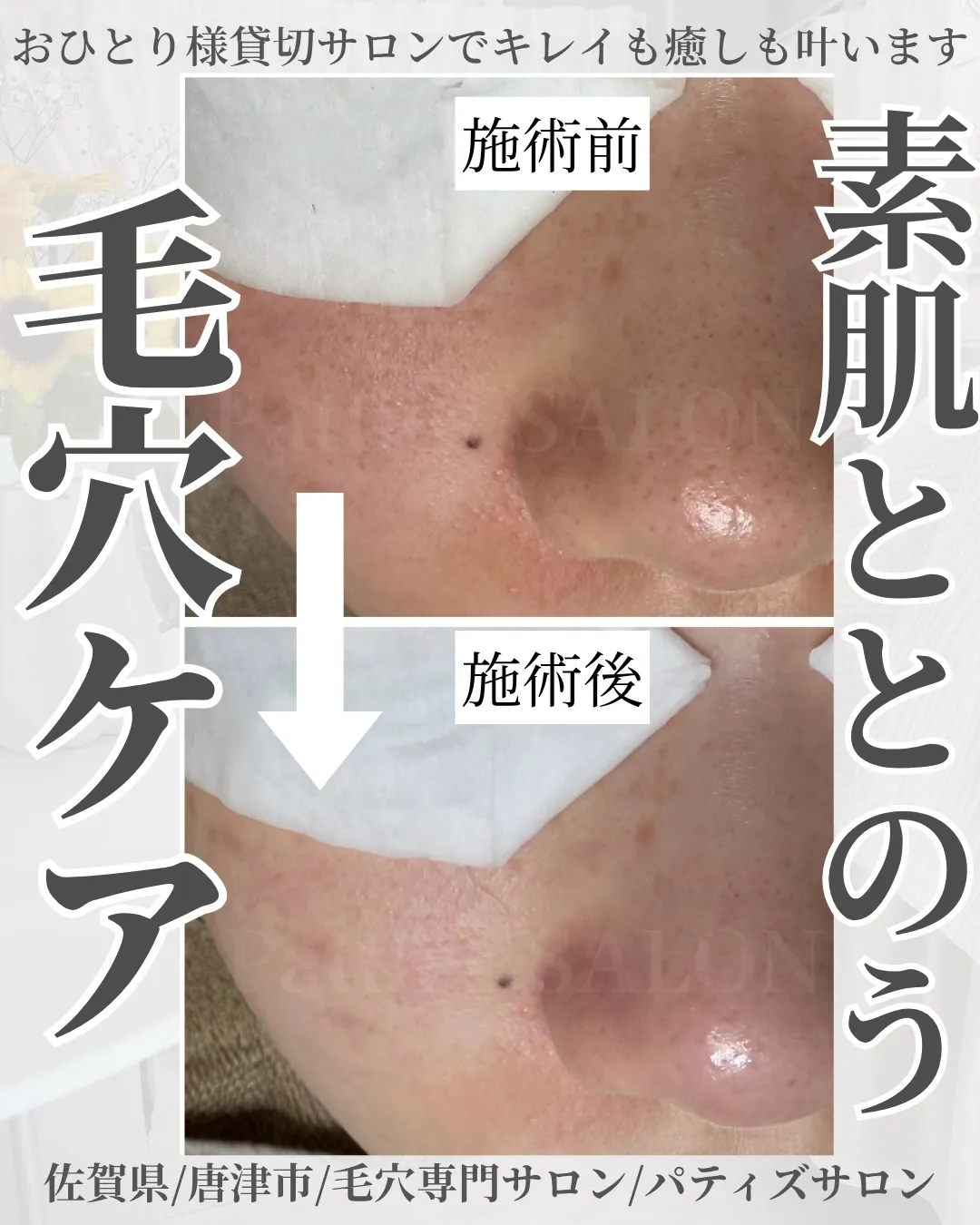 素肌ととのう毛穴ケア