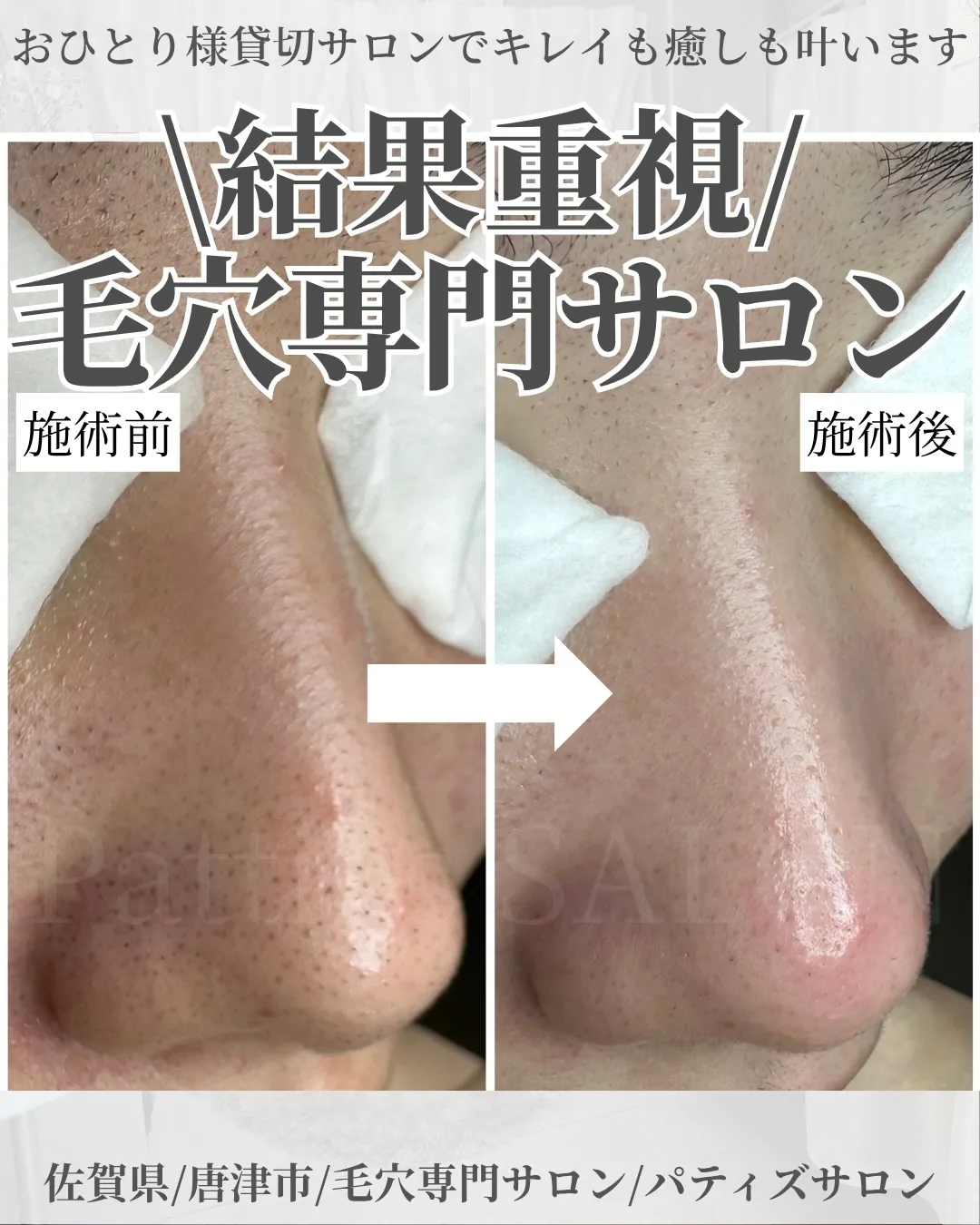 \結果重視/唐津市毛穴専門サロン